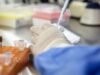 Η υπερφόρτιση των ανοσοποιητικών κυττάρων μπορεί να βοηθήσει στον μακροπρόθεσμο έλεγχο του HIV