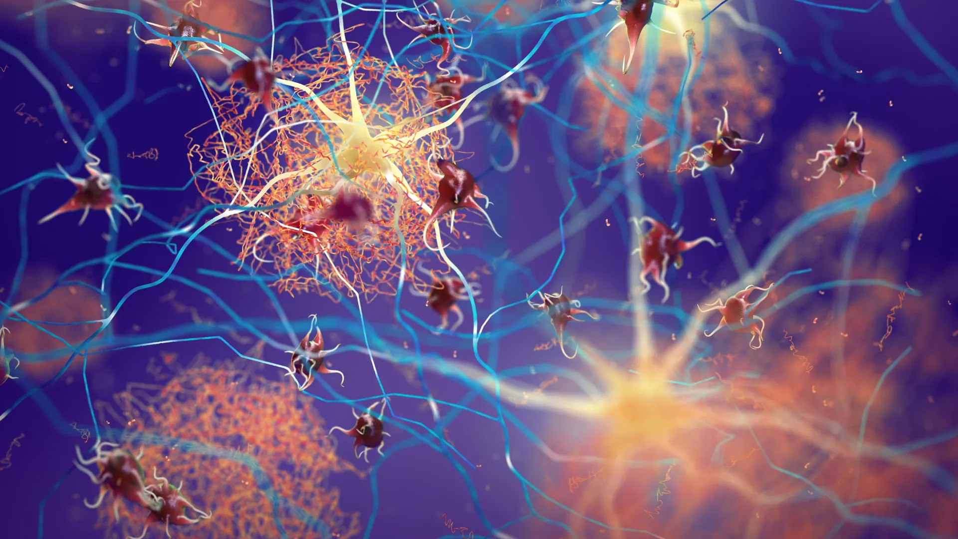 amyloid-plaques-forming-between-brain-neurons.webp.webp