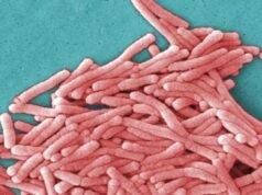 19 περιπτώσεις μόλυνσης από Legionella συνδέονται με νοσοκομεία της περιοχής Kaiser Bay